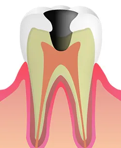 段階3（C2）